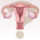 Illustration for article titled Who Needs Fallopian Tubes Anyway?